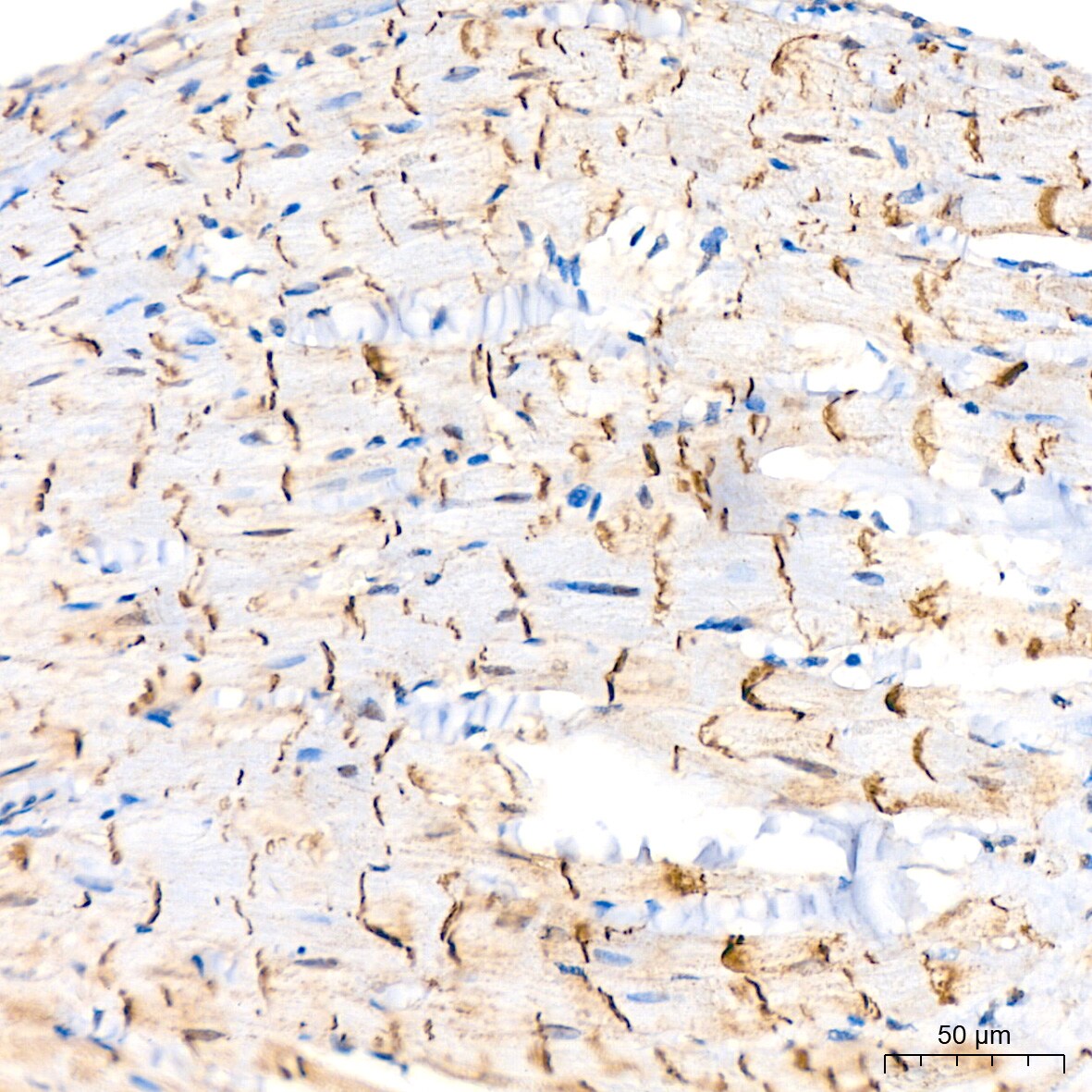 N-Cadherin Antibody (6F9G8)
