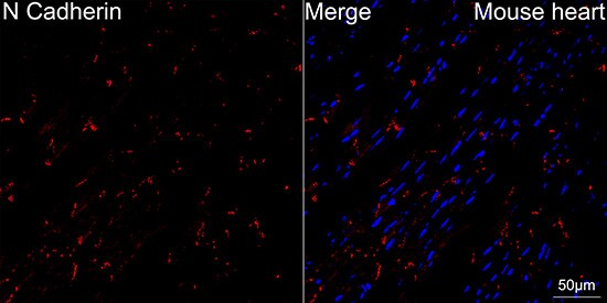 N-Cadherin Antibody (6F9G8)