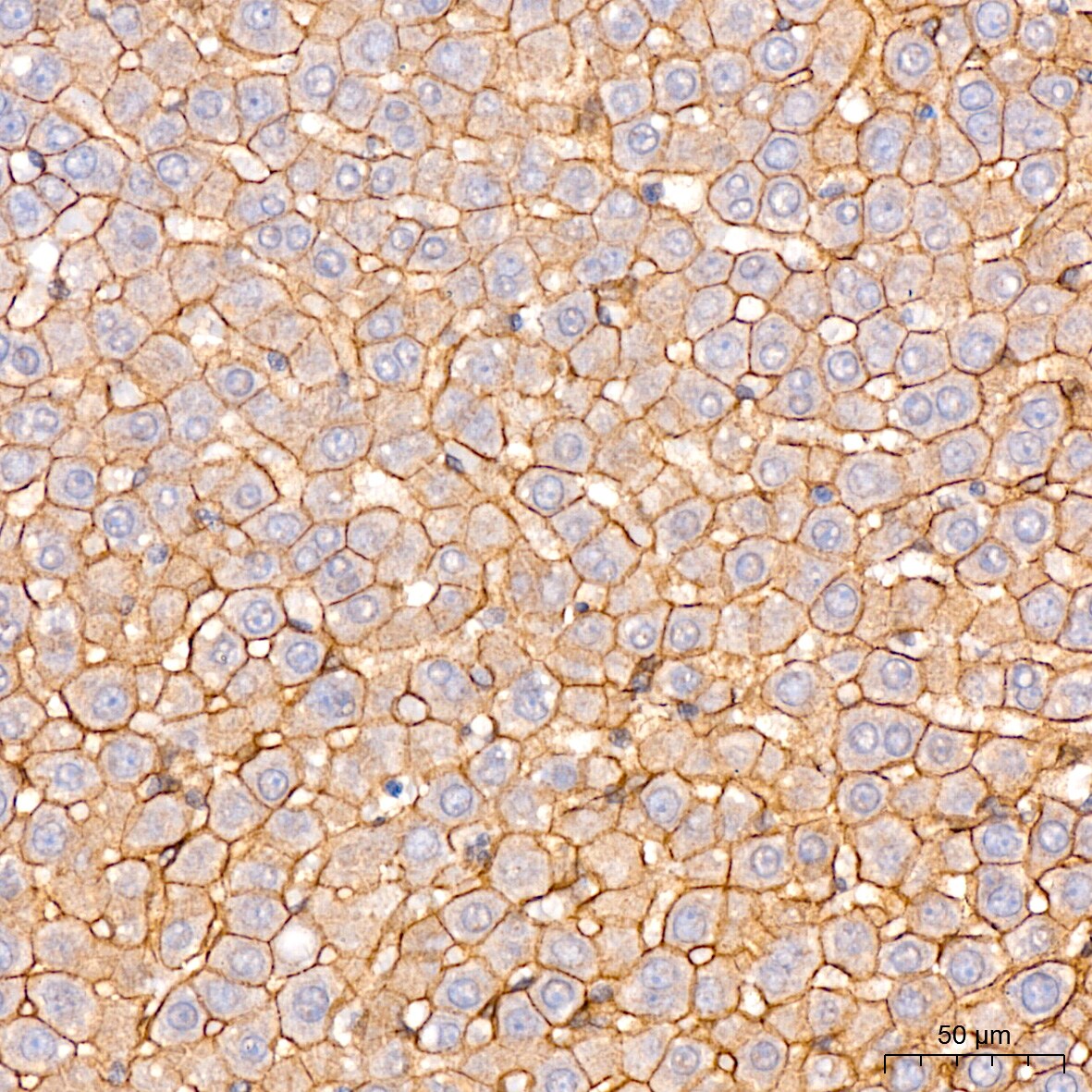 N-Cadherin Antibody (6F9G8)
