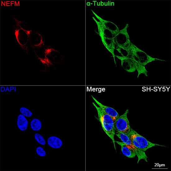 NF-M Antibody (5E0D2)