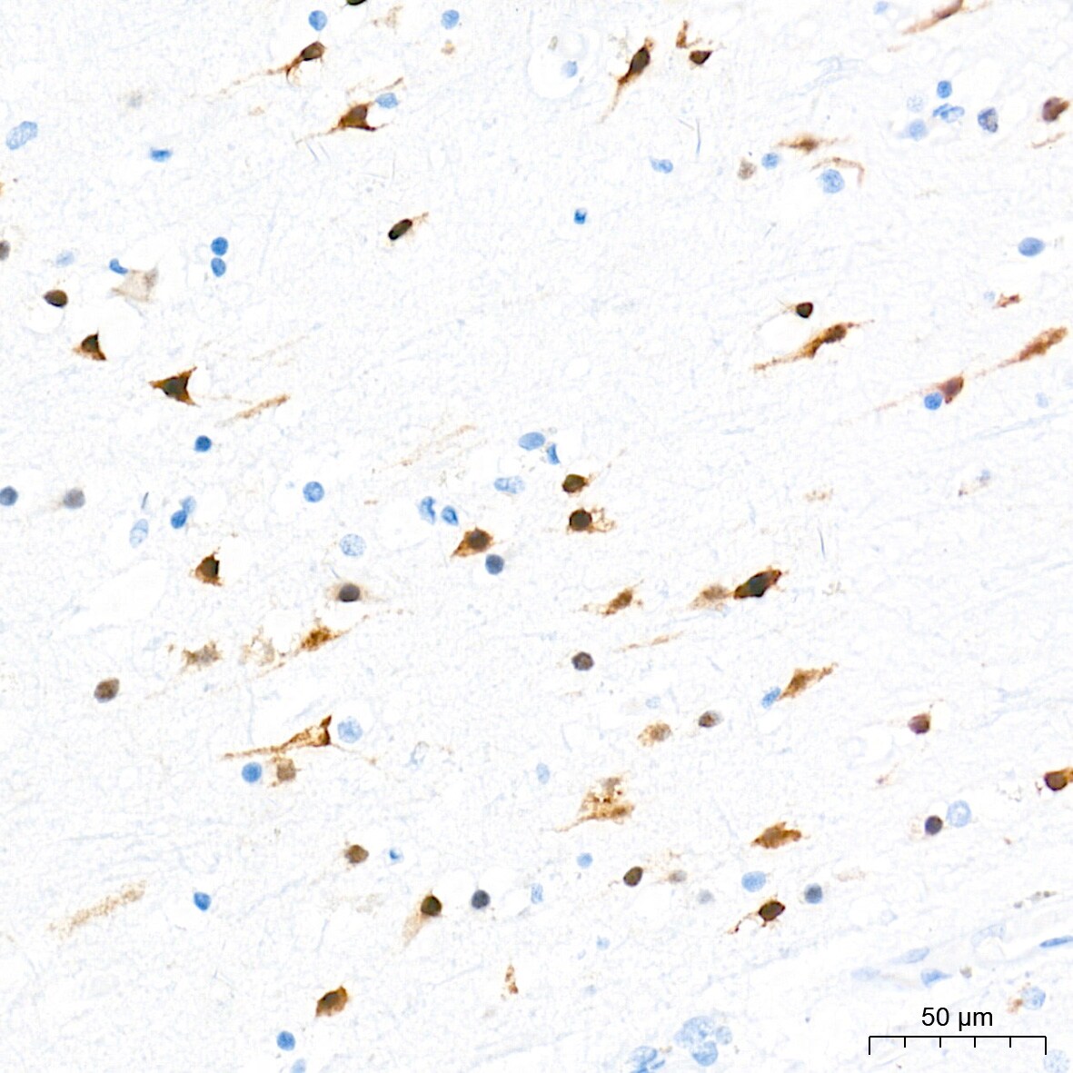 RBFOX3/NeuN Antibody (2F9F0)