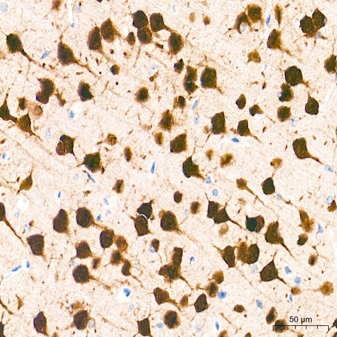 RBFOX3/NeuN Antibody (2F9F0)