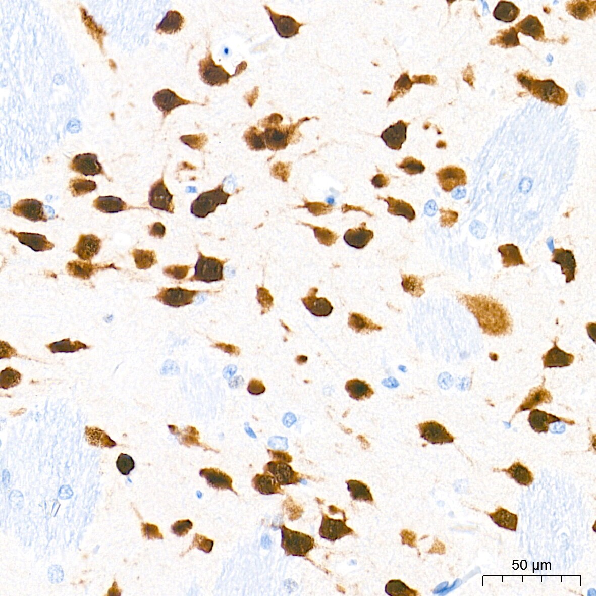RBFOX3/NeuN Antibody (2F9F0)