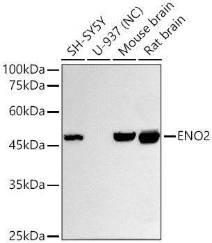 Enolase 2/Neuron-specific Enolase Antibody (9B4Y4)