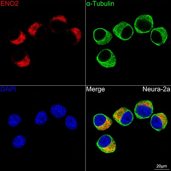 Enolase 2/Neuron-specific Enolase Antibody (9B4Y4)