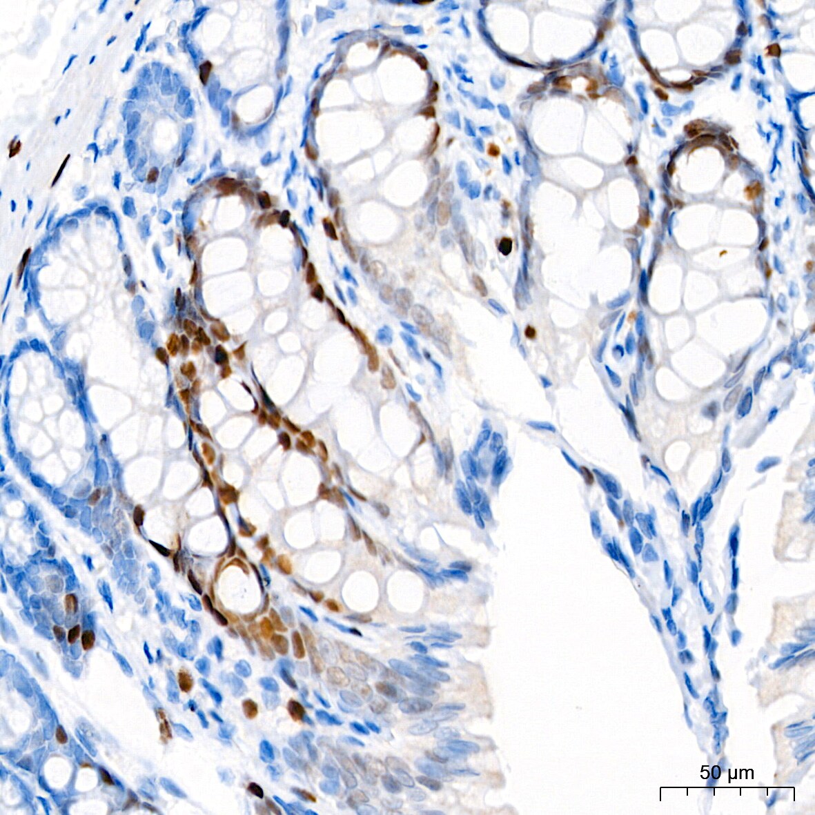 p21/CIP1/CDKN1A Antibody (4Z1H9)