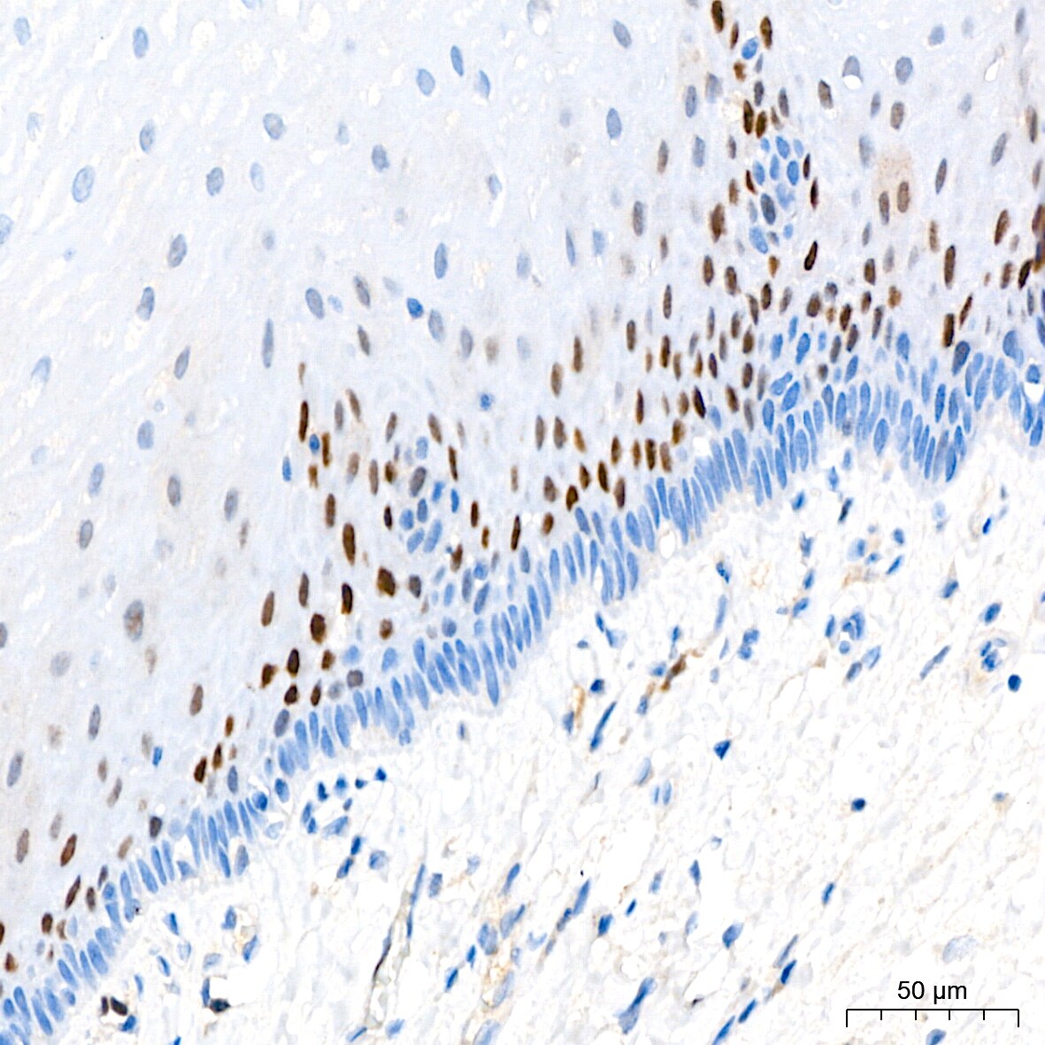 p21/CIP1/CDKN1A Antibody (4Z1H9)