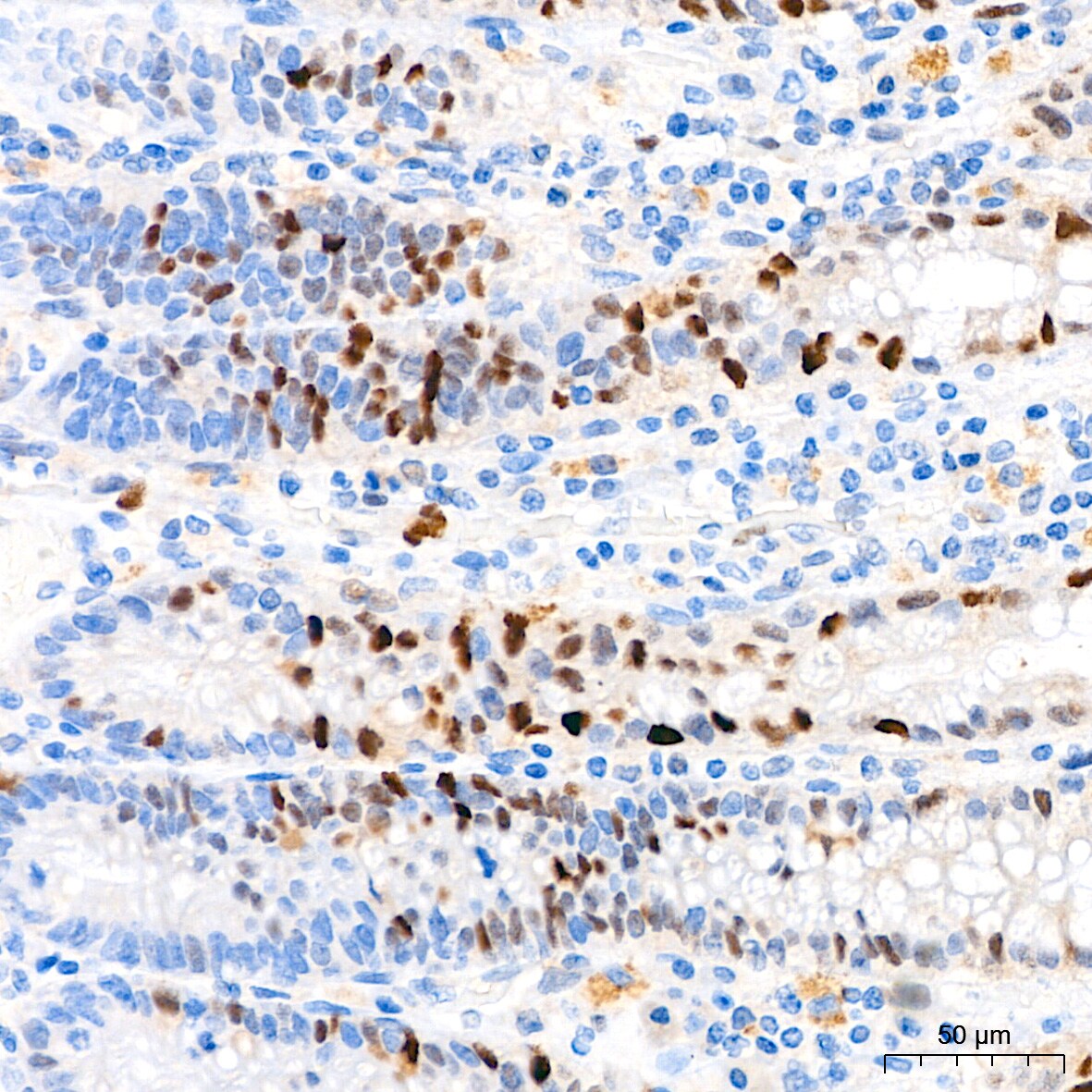 p21/CIP1/CDKN1A Antibody (4Z1H9)