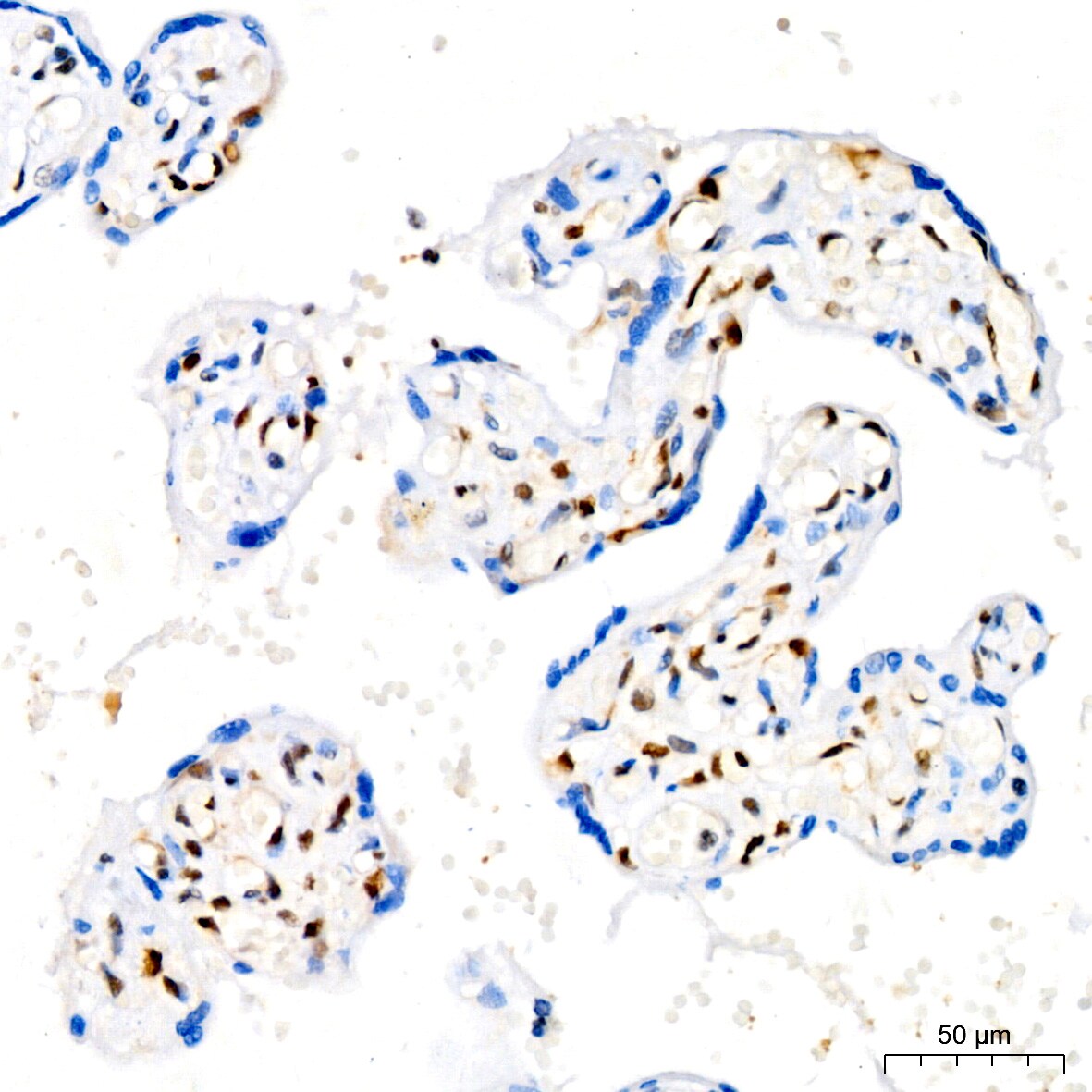 p27/Kip1 Antibody (9R5B4)