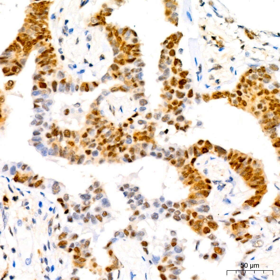 p27/Kip1 Antibody (9R5B4)