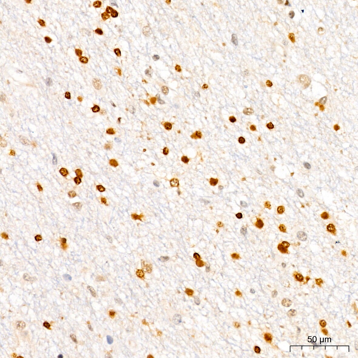 p27/Kip1 Antibody (9R5B4)