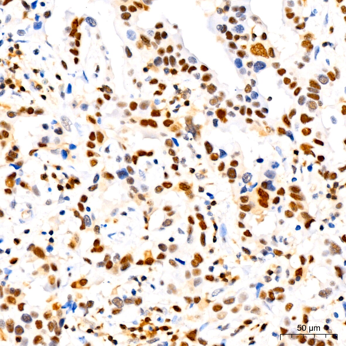 p27/Kip1 Antibody (9R5B4)