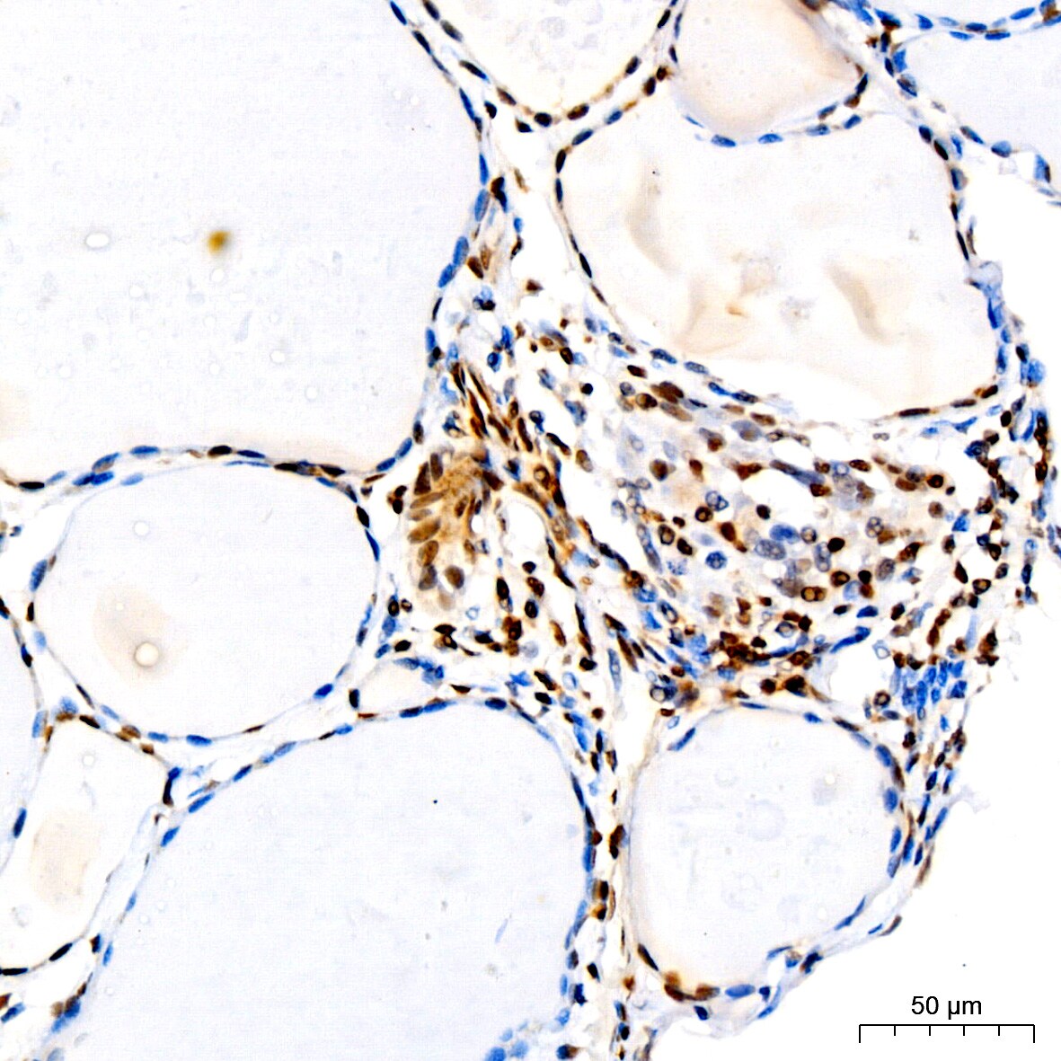 p27/Kip1 Antibody (9R5B4)