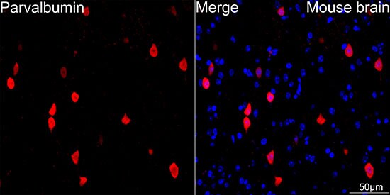 Parvalbumin Antibody (6C7K6)