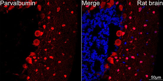 Parvalbumin Antibody (6C7K6)