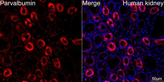 Parvalbumin Antibody (6C7K6)