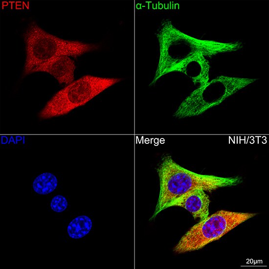 PTEN Antibody (7O6F4)