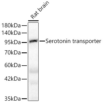 SLC6A4/5-HTTLPR/Serotonin transporter Antibody (5T7M2)