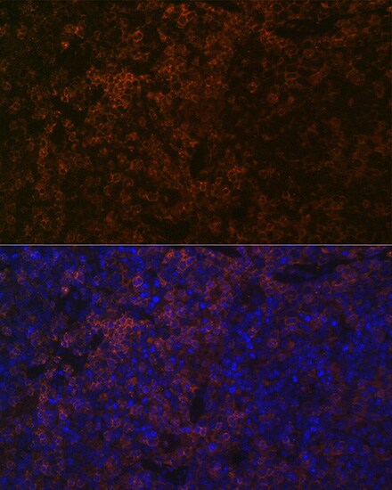 SHP-1 Antibody (7I1K3)