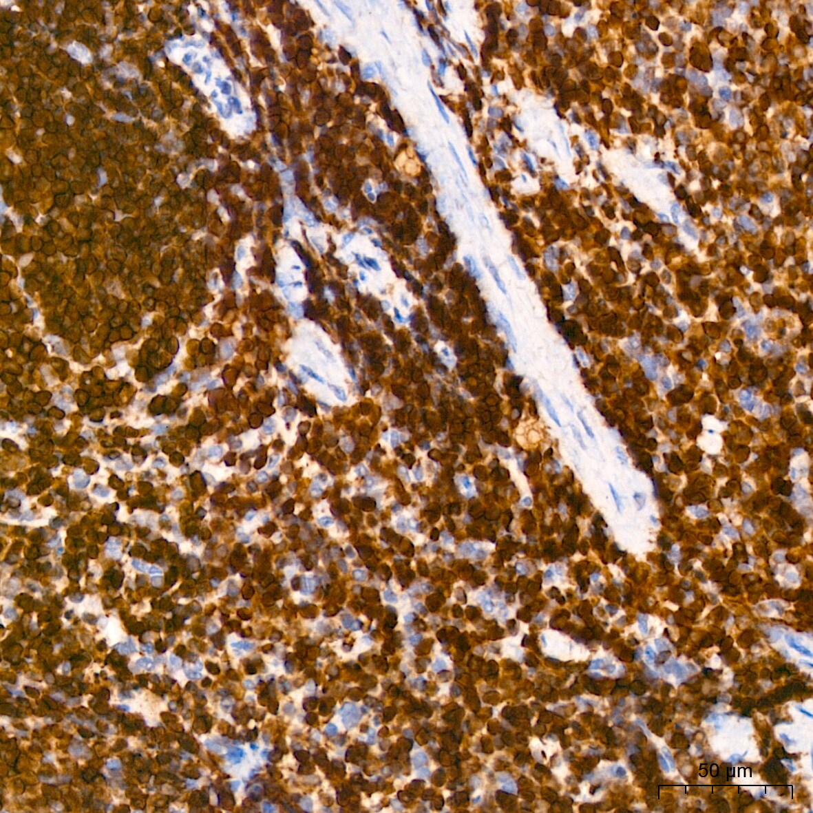 SHP-1 Antibody (7I1K3)
