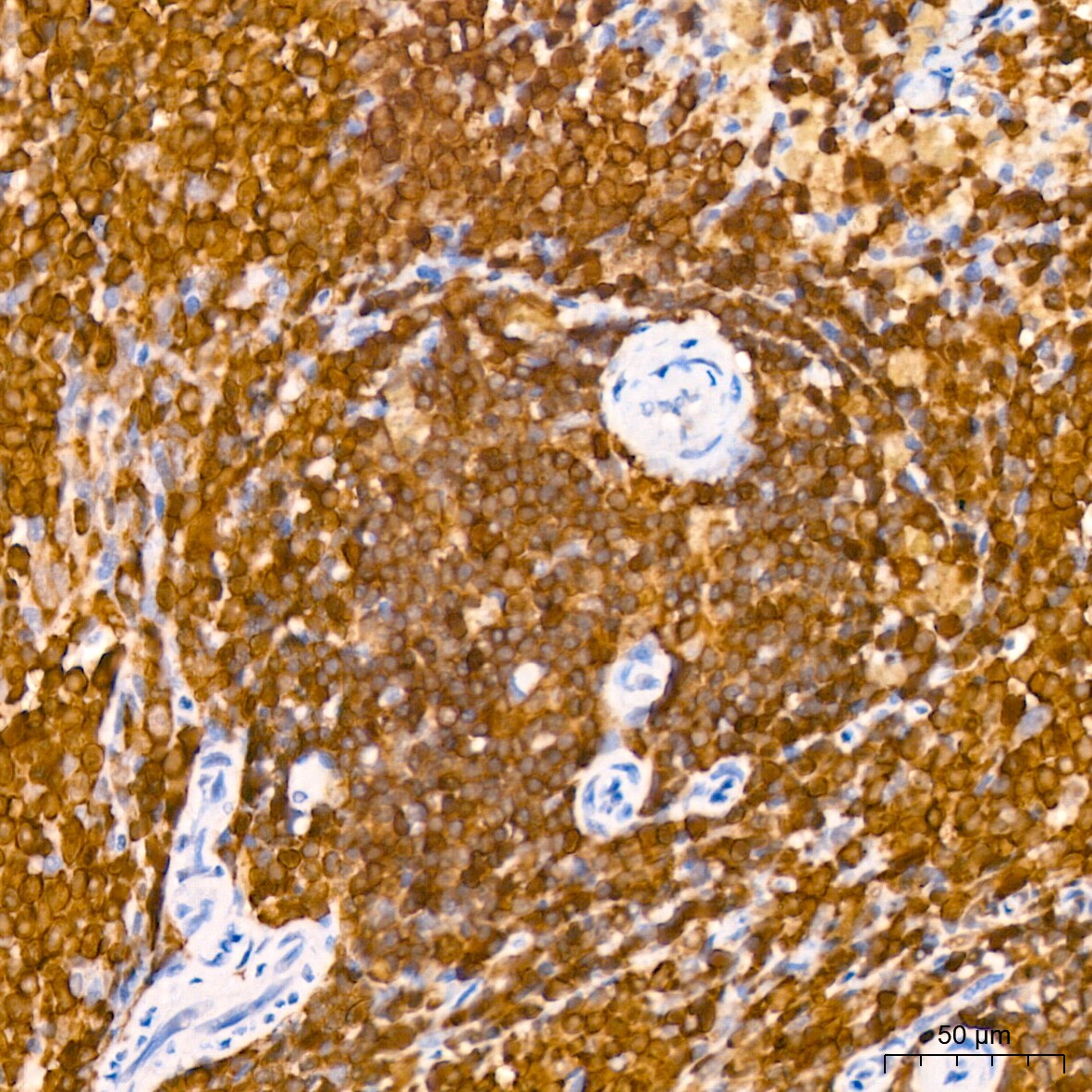 SHP-1 Antibody (7I1K3)