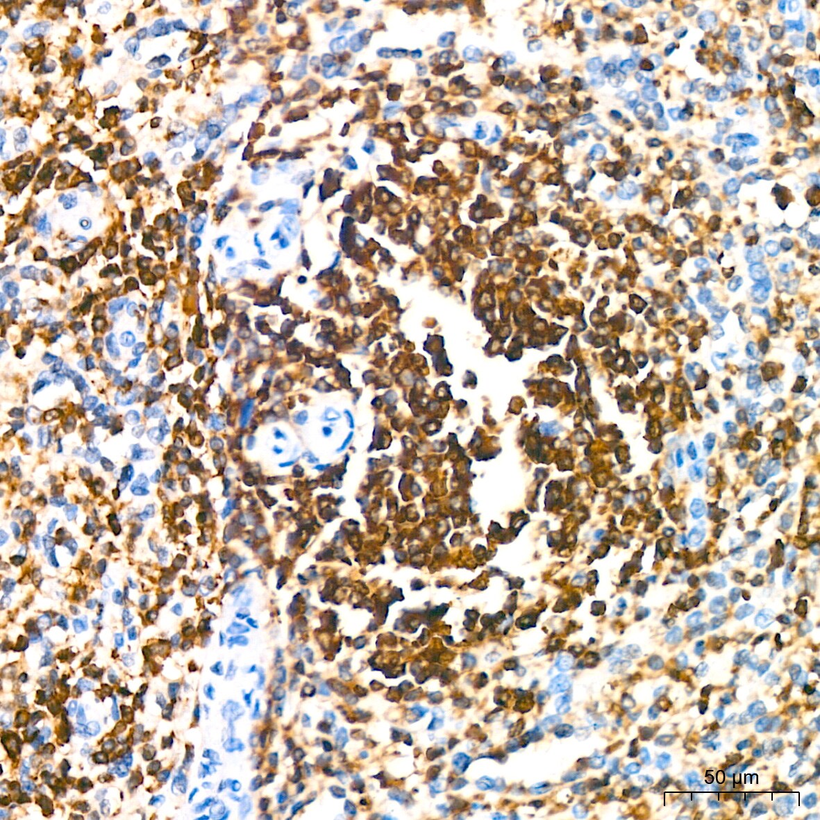 SHP-1 Antibody (7I1K3)