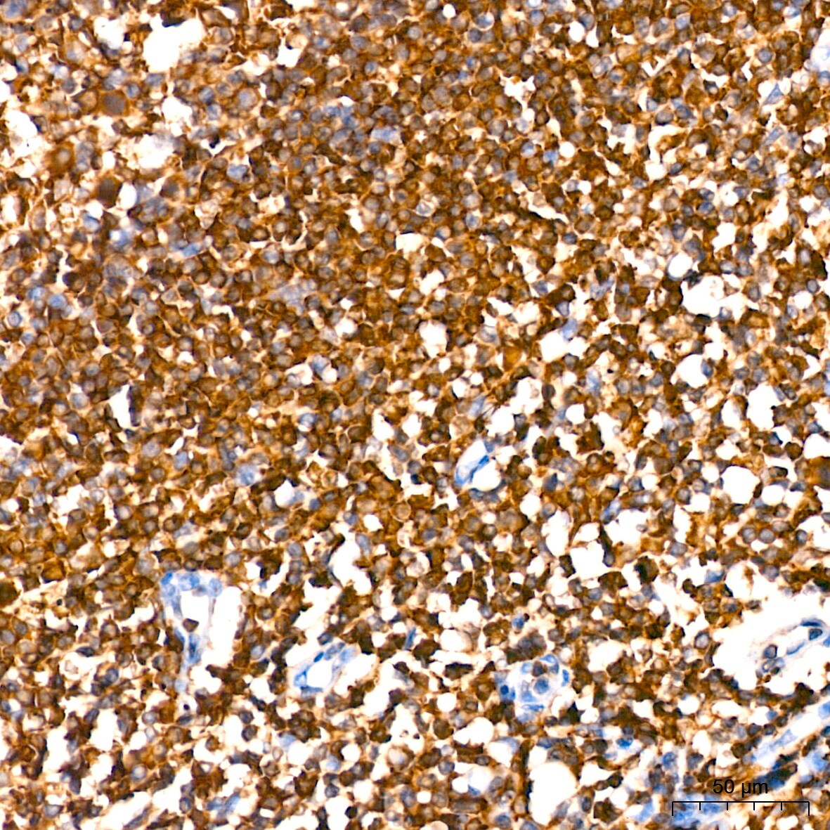 SHP-1 Antibody (7I1K3)