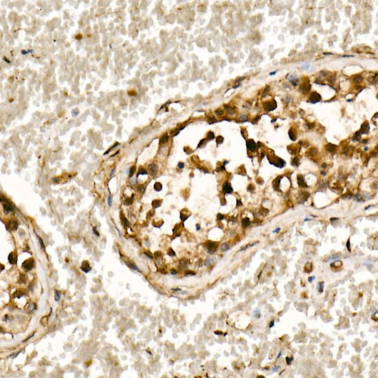 Smad3 Antibody (1T1Q9)