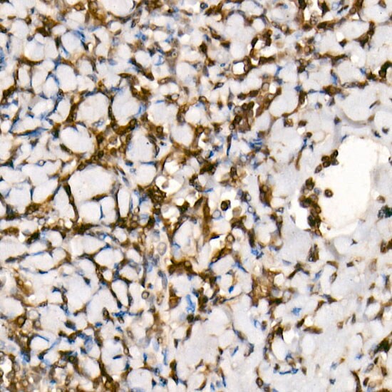 Smad3 Antibody (1T1Q9)