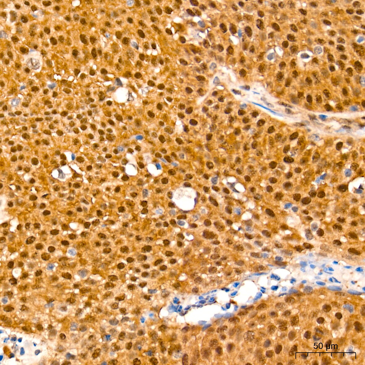 Smad4 Antibody (6B4D6)