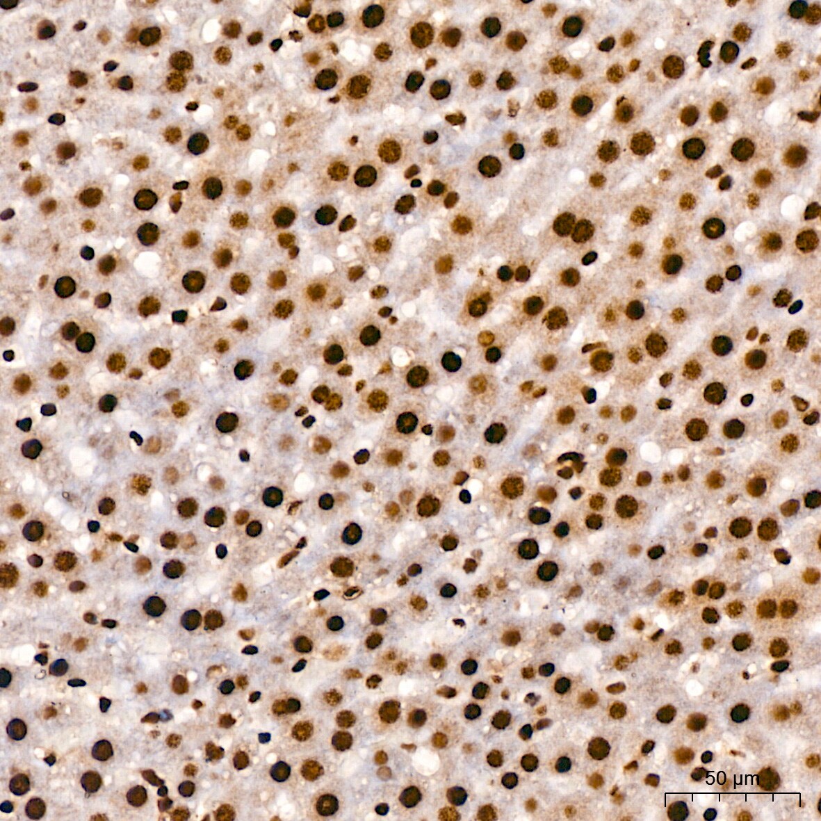 TDP-43/TARDBP Antibody (4R5L7)
