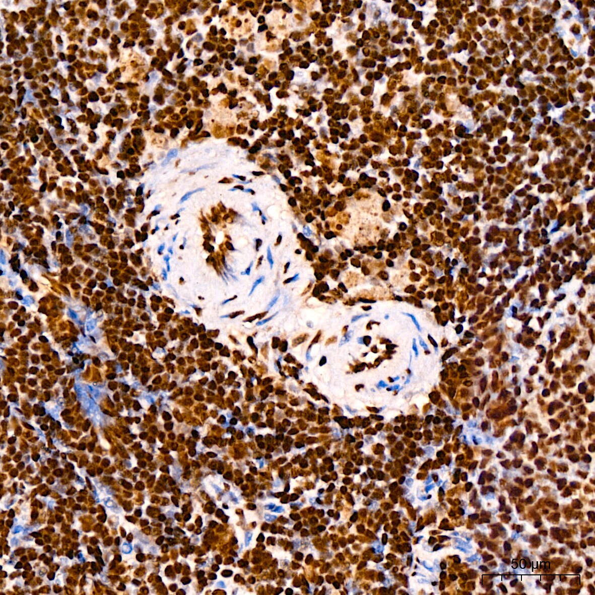 TDP-43/TARDBP Antibody (4R5L7)
