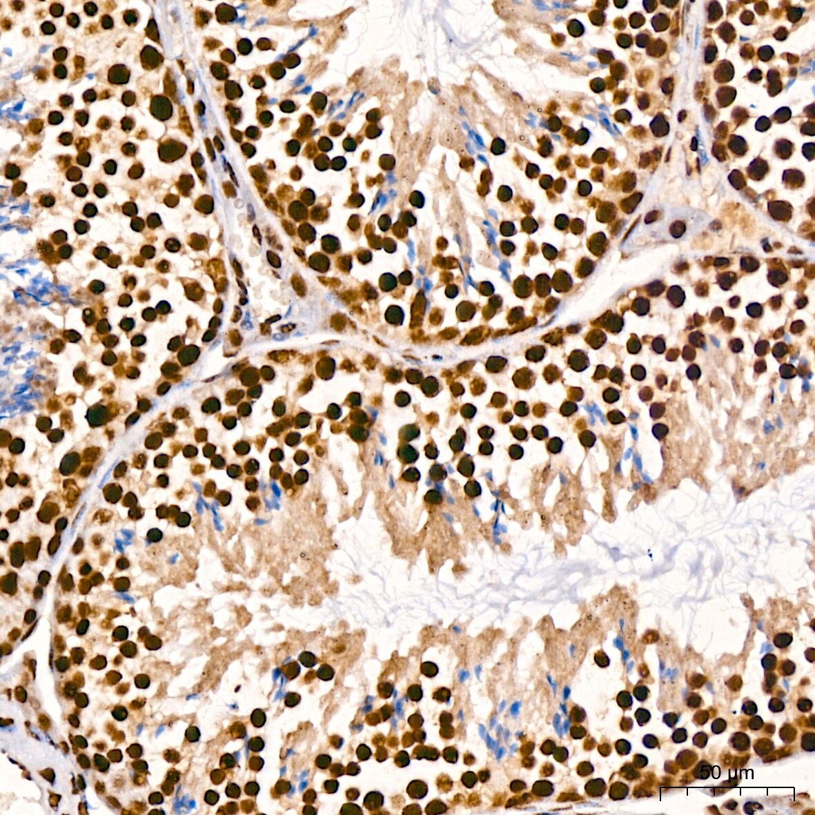 TDP-43/TARDBP Antibody (4R5L7)