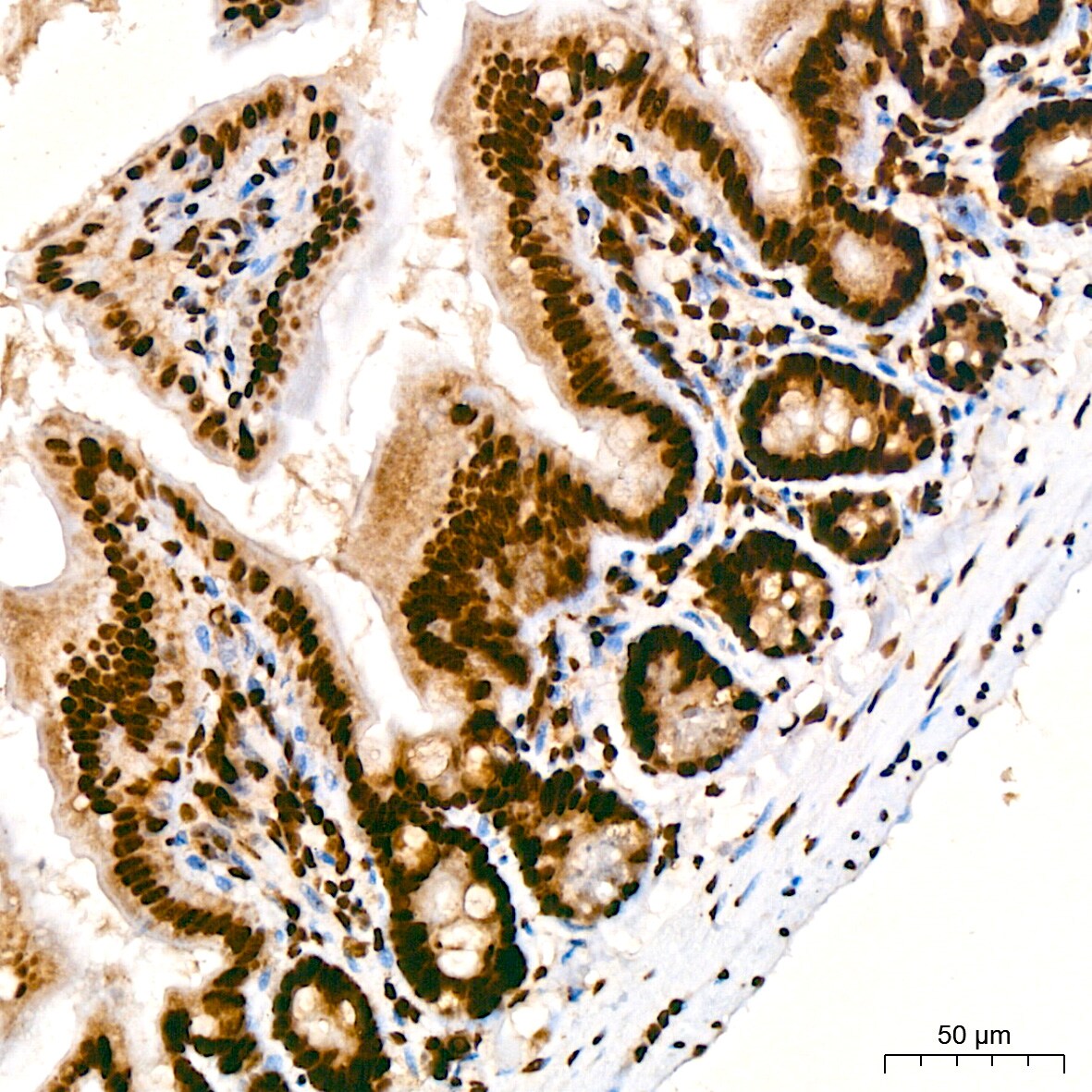 TDP-43/TARDBP Antibody (4R5L7)