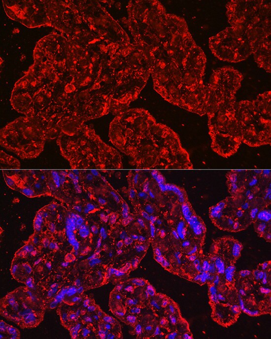 EG-VEGF/PK1 Antibody (1B4G2)