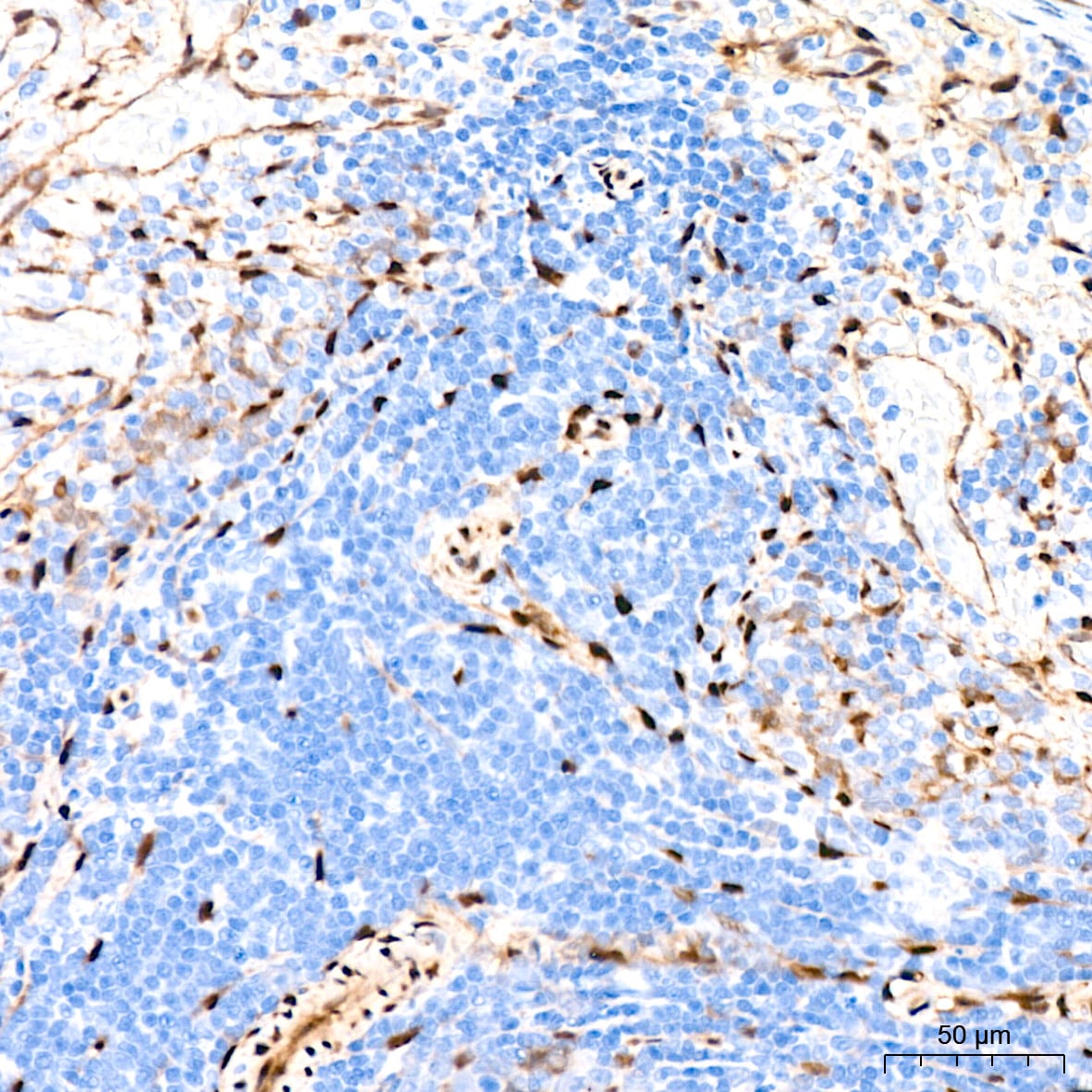 YAP1 Antibody (10G4S10)