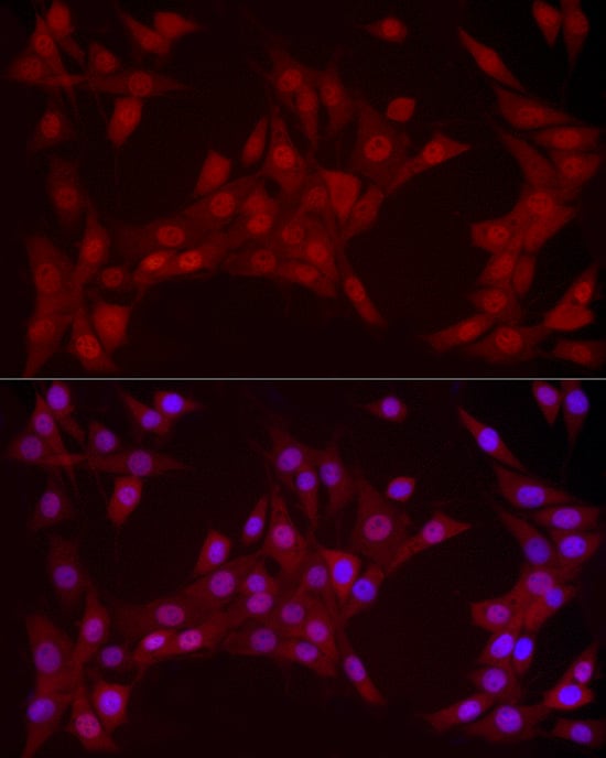 YAP1 Antibody (10G4S10)