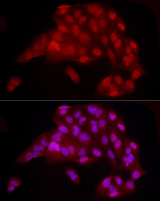 YAP1 Antibody (10G4S10)