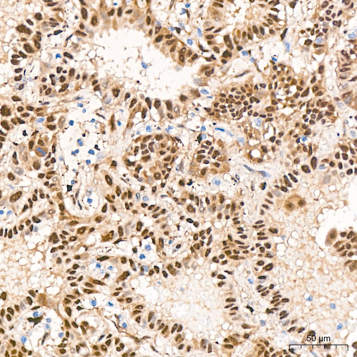 YAP1 Antibody (10G4S10)