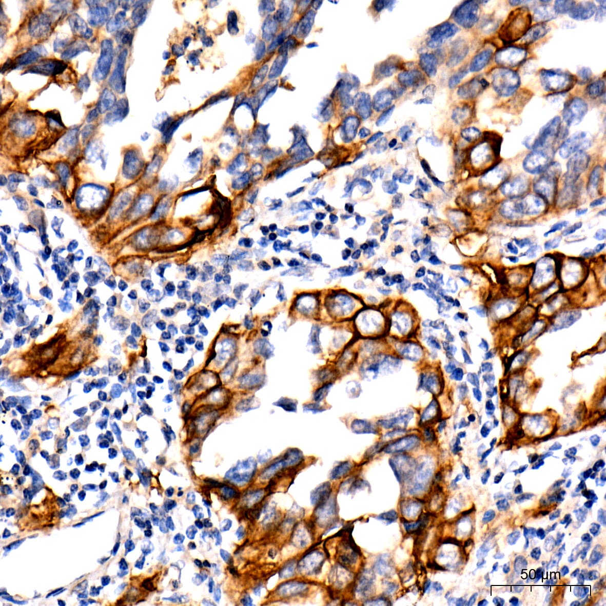 PD-L1 Antibody (4V8L4)