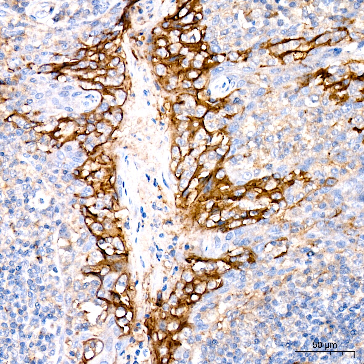 PD-L1 Antibody (4V8L4)