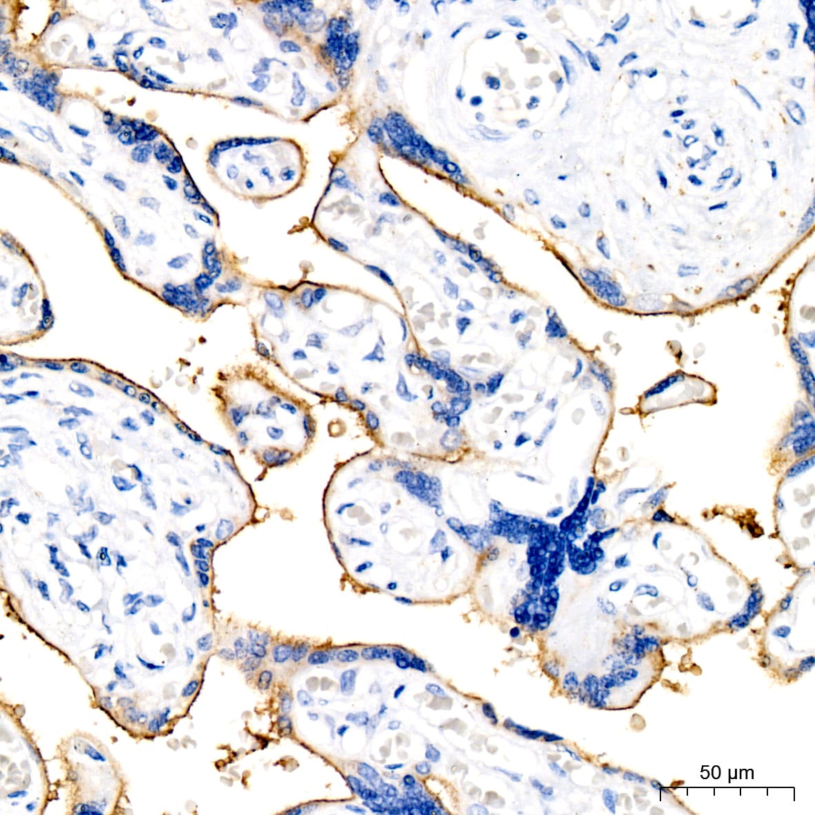 PD-L1 Antibody (4V8L4)