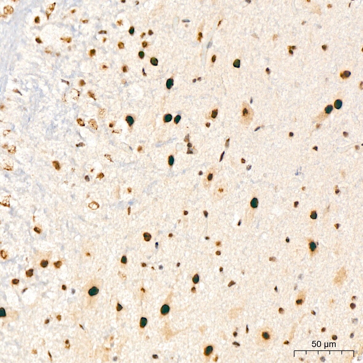 XPD Antibody (6T9K6)