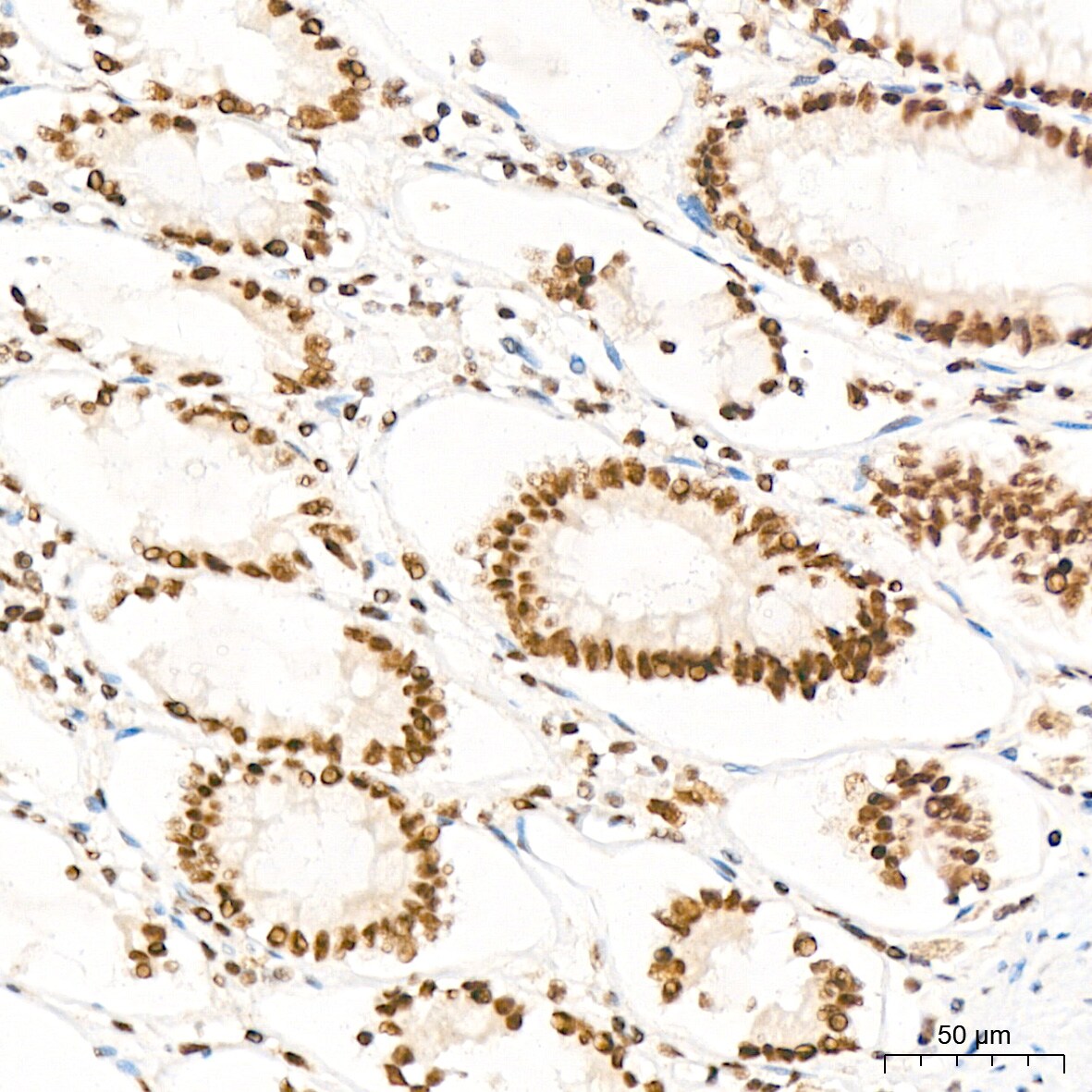XPD Antibody (6T9K6)