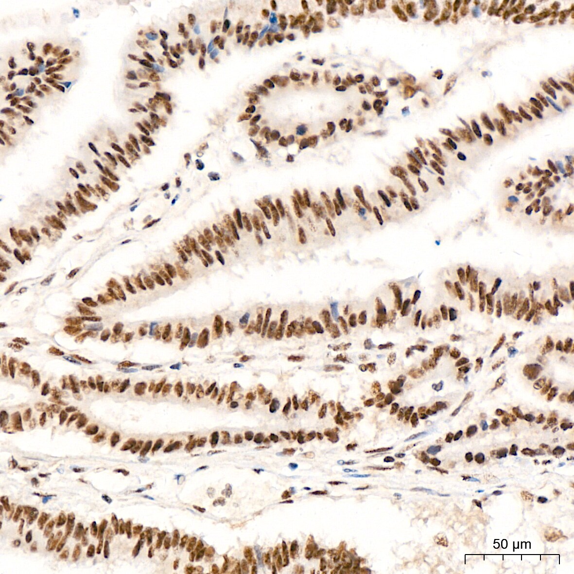 XPD Antibody (6T9K6)