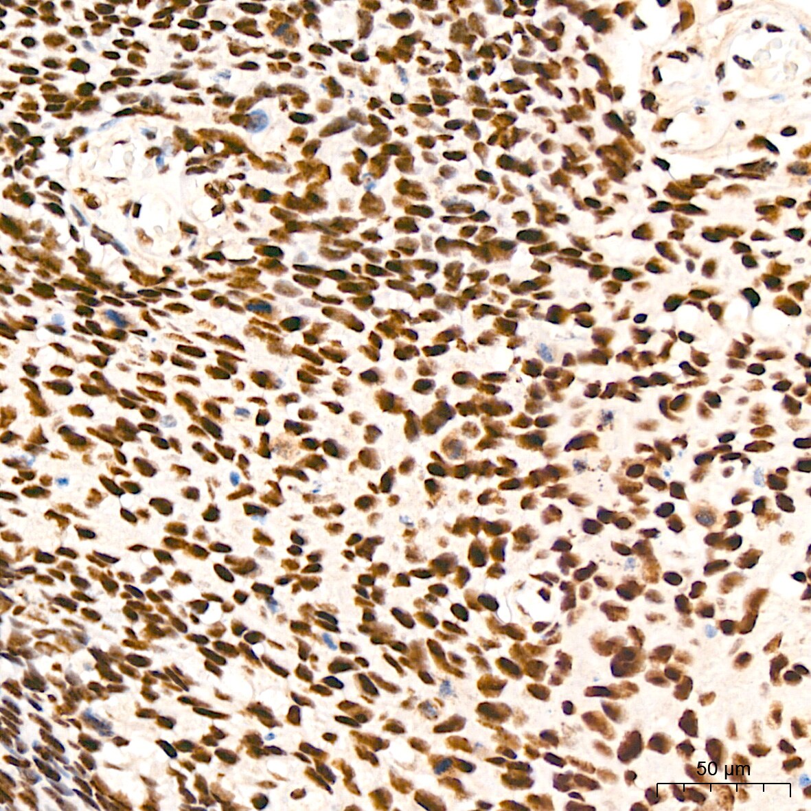 XPD Antibody (6T9K6)