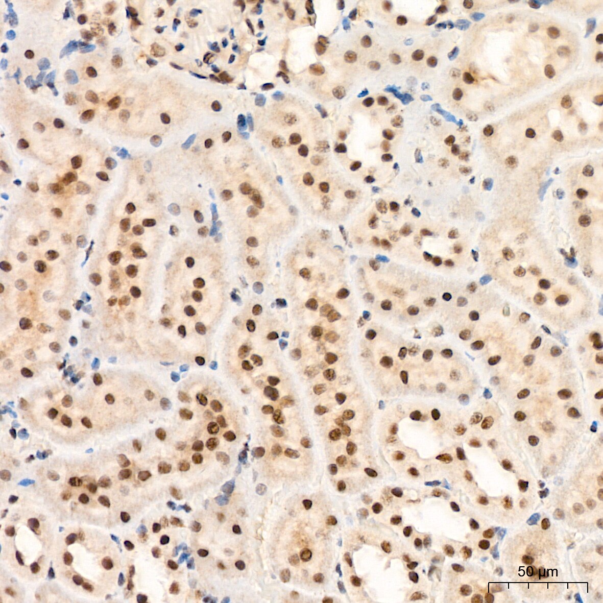XPD Antibody (6T9K6)