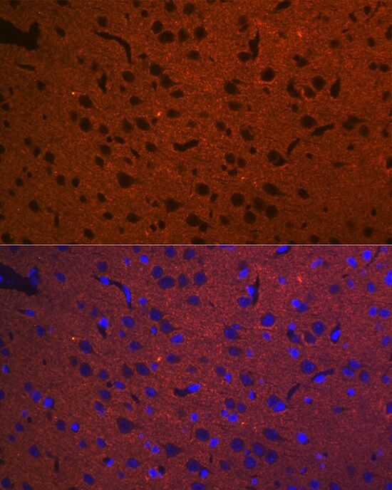 Syntaxin 1A Antibody (2B2F10)