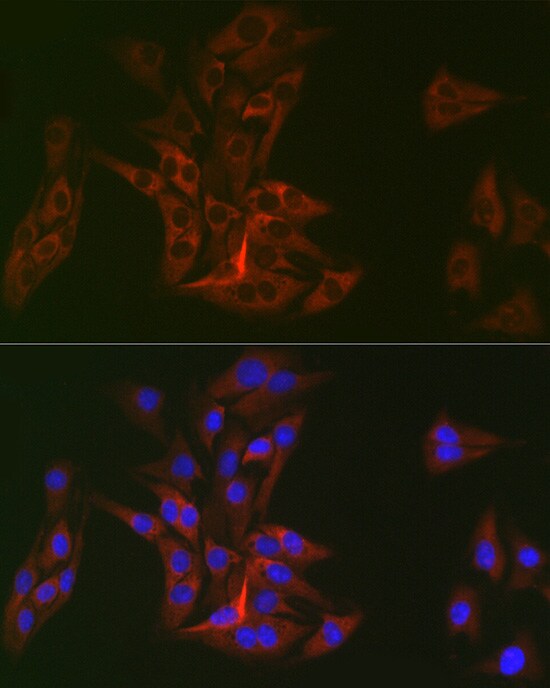 DOK1 Antibody (6U4U9)