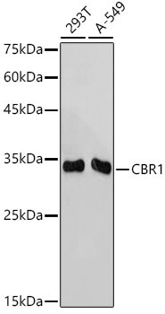 CBR1 Antibody (3A9O5)